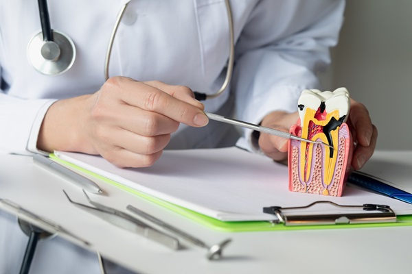 Root Canal Recovery: What To Expect After Undergoing Therapy